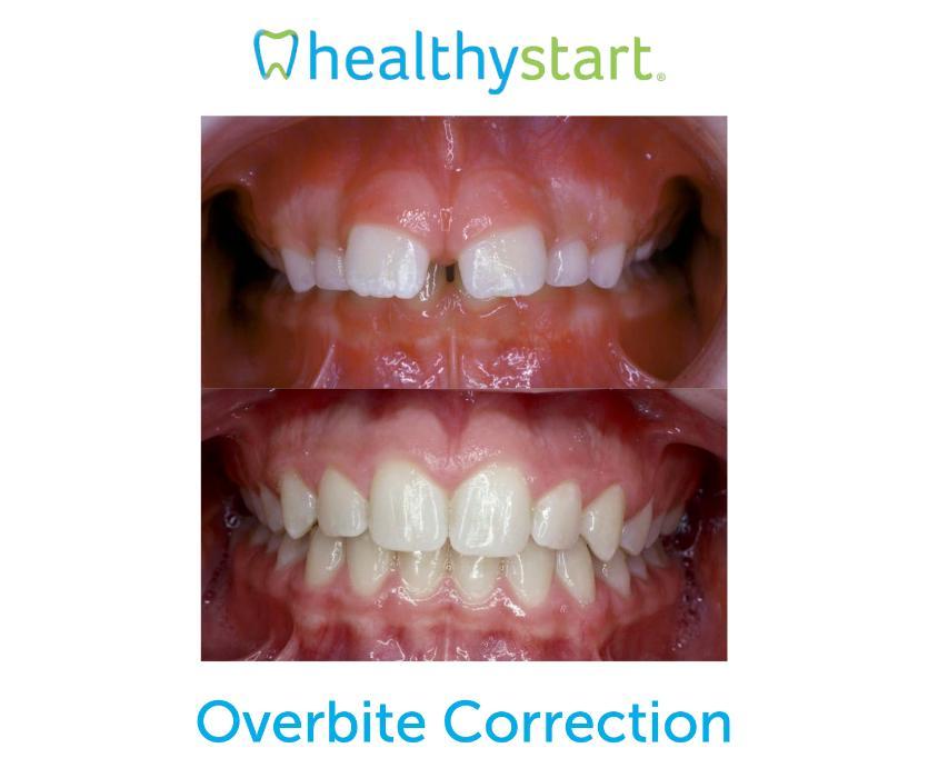 Pediatric Dentist Mission Viejo