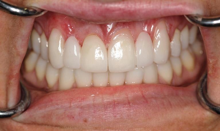 dentist-bridge-mission-viejo