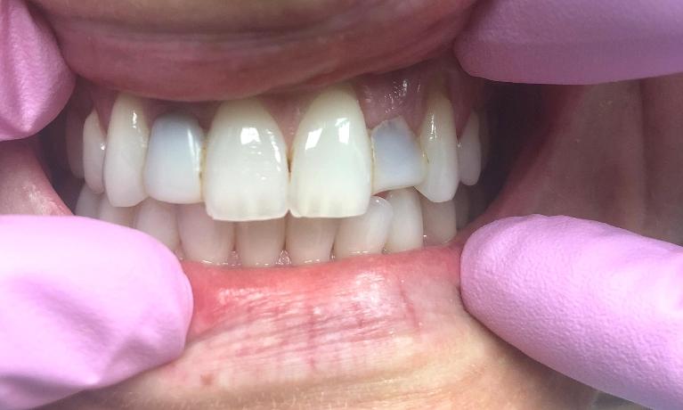 cosmetic-dentist-mission-viejo